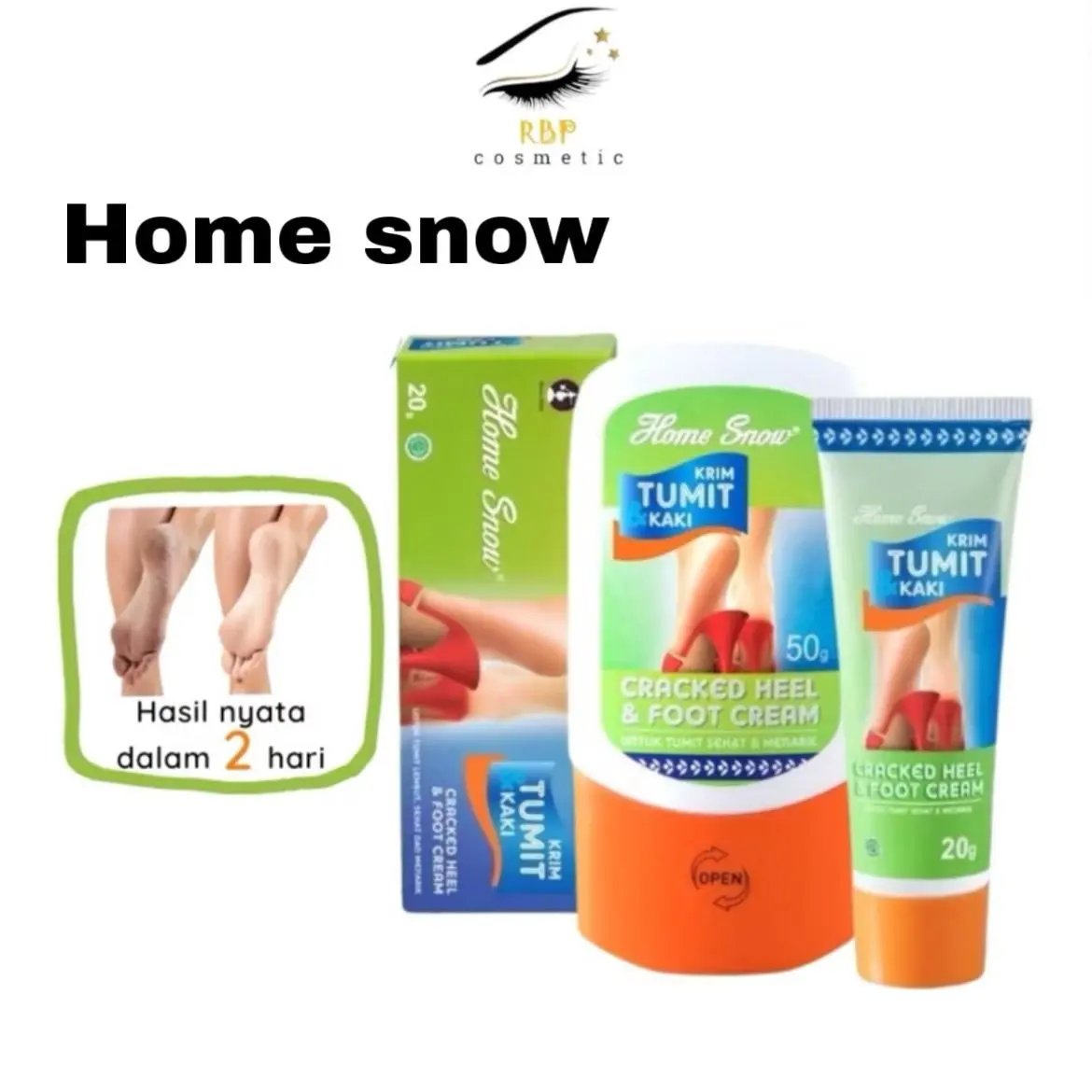 Home Snow 20g 50g – Atasi Kaki Pecah & Kering, Tumit Kasar, Mencerahkan Siku Lutut