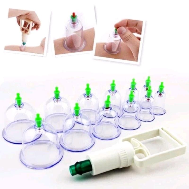 bộ giác hơi 12 món không dùng lửa có dây nối ,an toàn _ hút chân không,loại bỏ các loại bệnh như trúng gió,cảm lạnh