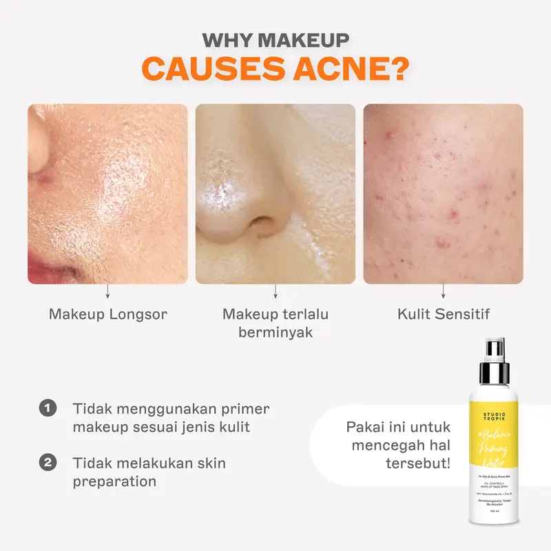 STUDIO TROPIK Balance Priming Water | Primer Face Mist Spray Rekomendasi MUA | Makeup Complexion | Kulit Berjerawat, Acne prone, oily berminyak | Dengan Niacinamide dan Zinc| Finish Matte 2