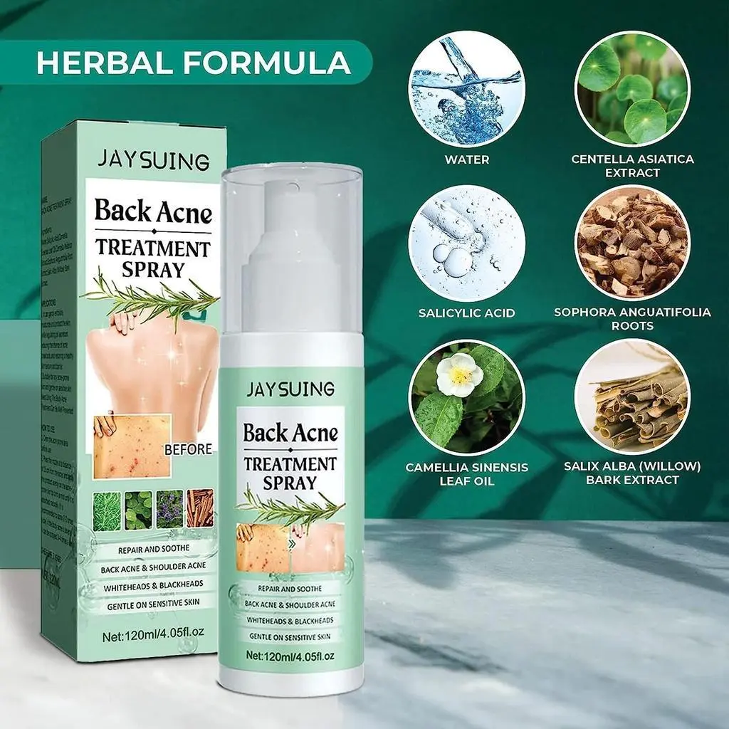 Điều trị mụn lưng, 120ml, Xịt mụn lưng, Xịt axit salicylic 2%, Điều trị mụn trên cơ thể với công thức thảo dược, Xịt mụn trên cơ thể, Xịt dầu cây trà