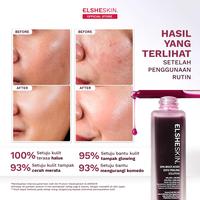Gambar [NEW LAUNCH] Elsheskin Multi Acids Exfo Peeling Solution 35ml - Exfoliating Serum, Serum Eksfoliasi Wajah, Membantu Mengangkat Sel Kulit Mati, Brightening, Mencerahkan Kulit Kusam, Membersihkan Komedo, Pori, Menghaluskan Tekstur Kulit Essence Memutihkan - Exfo Peeling Solution dari Elsheskin Kota Tangerang Selatan 3 Tokopedia