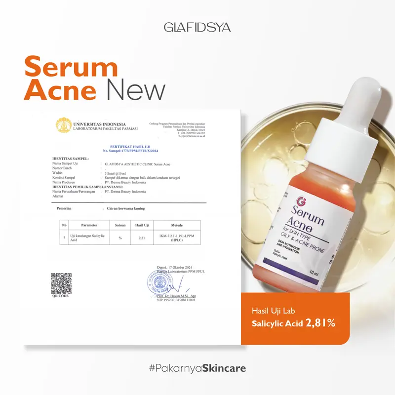GLAFIDSYA - Serum Acne New - Membantu Mengeringkan Jerawat Aktif 1