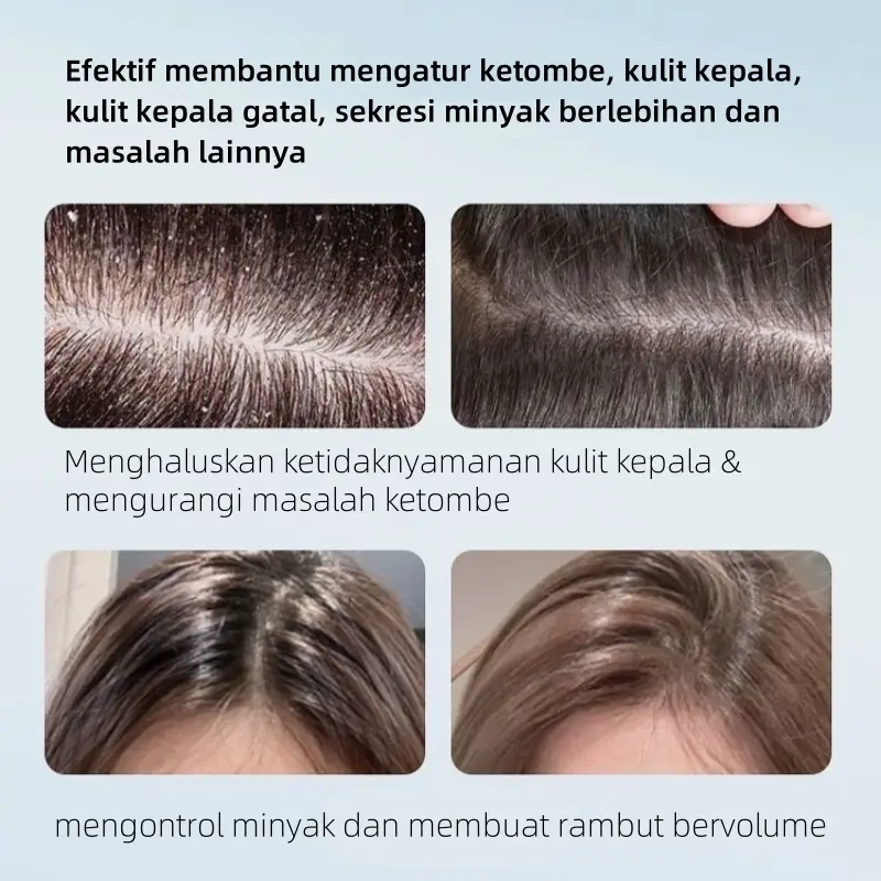 NIPPORI Selenium Disulfide Haircare Shampoo Helps control oil and dandruff Membantu mengontrol minyak dan ketombe Gatal Perawatan Sampo 300ML 2