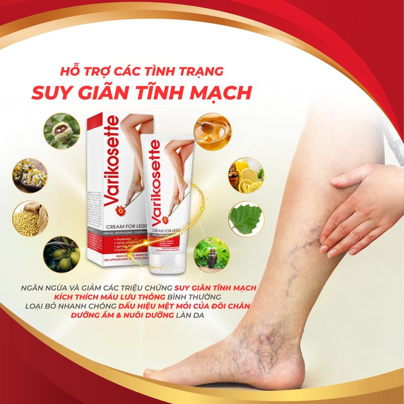 KEM BÔI GIÃN TĨNH MẠCH  VARIKOSETTE HÀNG CHĨNH HÃNG CỦA NGA