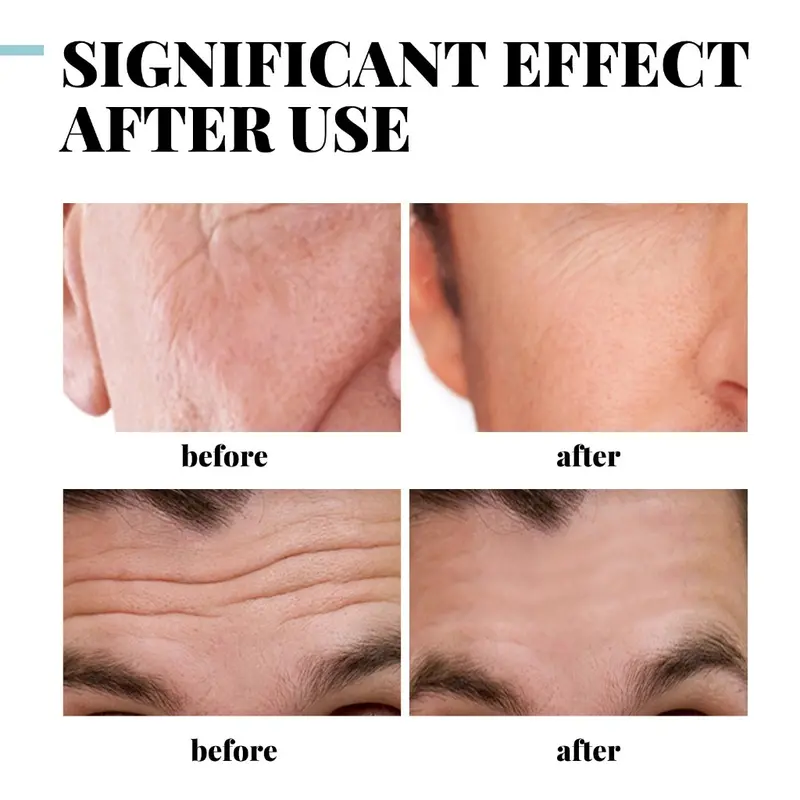 Krim Pria Pemutih Wajah Pelembut Penipis Anti Kerut Penuaan Penghilang Keriput Krim Perawatan Kulit - EELHOE Men's Collagen Cream 30g 2