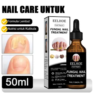 50ml Cairan Perawatan Kuku Nail Care Untuk Jamur Kuku Perawatan Jamur Kuku Jamur Kuku Nail Art Perawatan Jamur Kuku Lembut Cairan Perbaikan Kulit Mati Pelembab Nutrisi Kuku