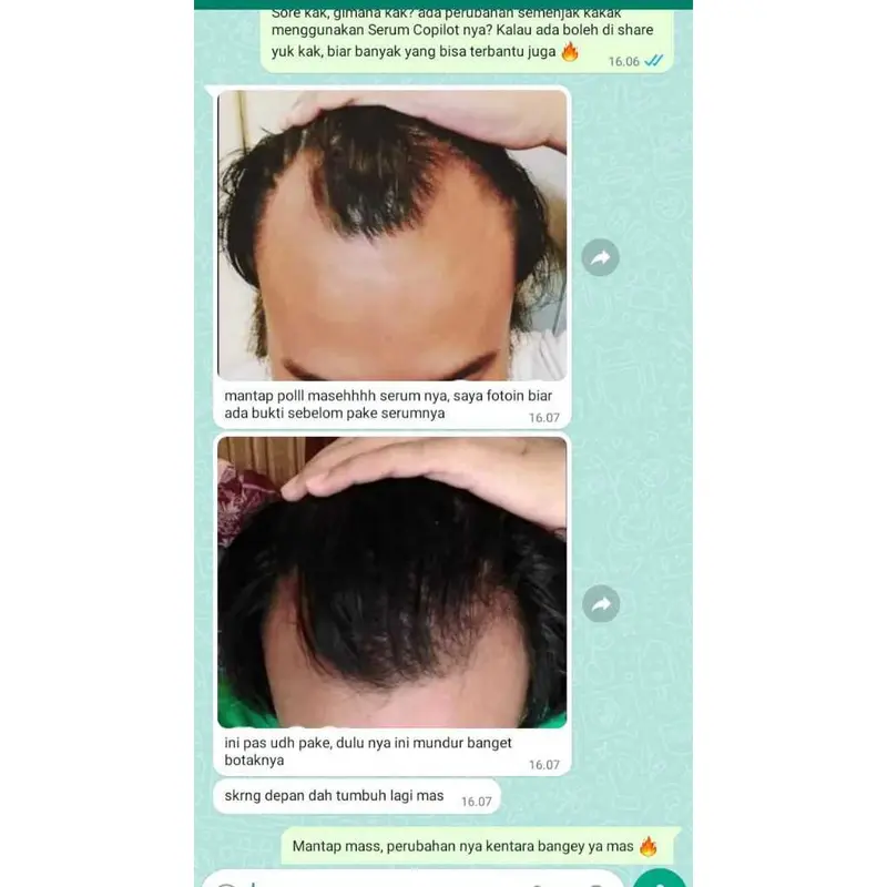 COPILOT HAIR BOOSTER SERUM Penumbuh Rambut Botak, Pelebat rambut, mempercepat pertumbuhan rambut 7