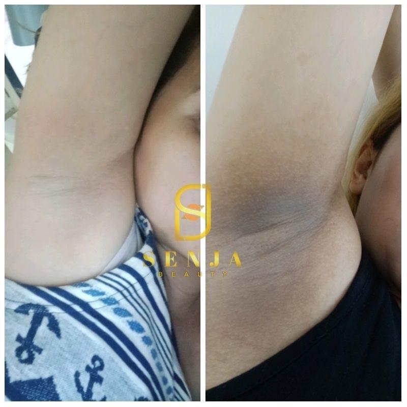 Senjalux Cream Lipatan Senjalux Whitening Underarm With Niacinamide 15gr Mencerahkan Ketiak Leher Siku Lutut Mata Kaki dll BPOM NA18241904039 Pencerah Tubuh