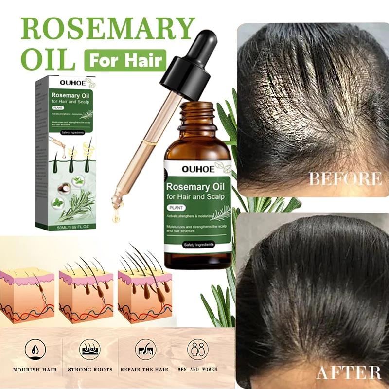 Rosemary hair oil hair tonic penumbuh rambut dengan cepat dan botak tebal serum rambut rontok Hair growth serum Minyak 5