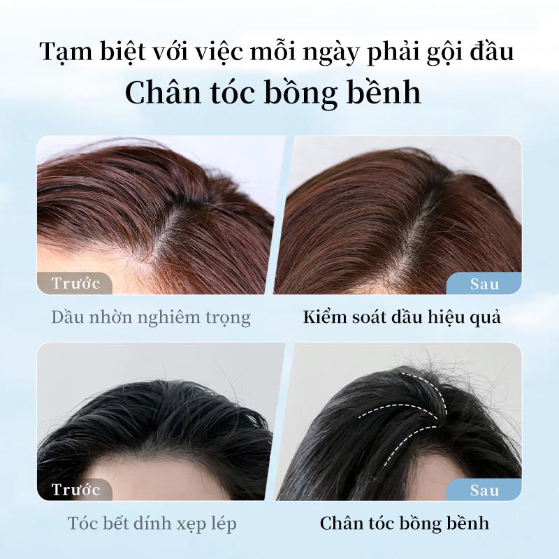 Dầu Gội Kiểm Soát Dầu, Jkck, Mạnh Mẽ, Nhẹ, Bồng Bềnh, Giảm Gàu 4