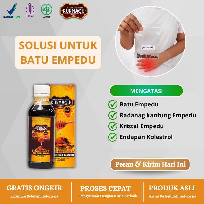 Atasi Batu Empedu, Radang Kantung Empedu, dan Endapan Kolesterol Secara Alami dengan Kurmaqu madu herbal 1