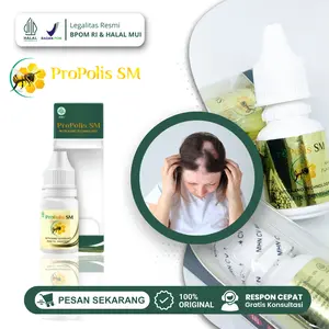 Propolis SM Atasi Rambut Pitak Alopecia Areata, Penumbuh Rambut Pitak Gatal Rontok