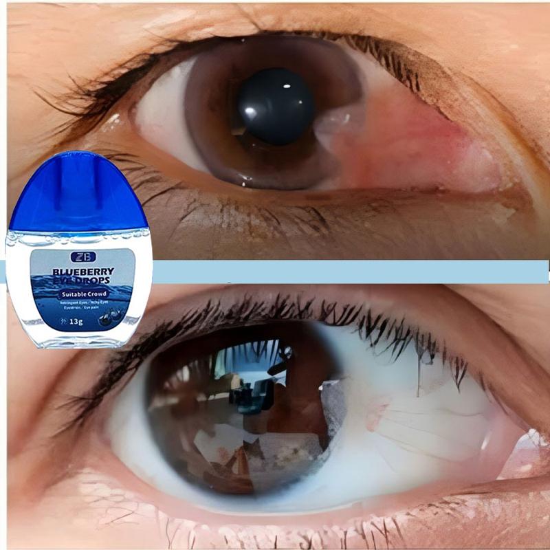 Product Introduction of Tetes Mata Weter On Untuk Mata Minus Katarak Glaukoma Cylinder,Buram,Sliau Softlens Lens Eye 11