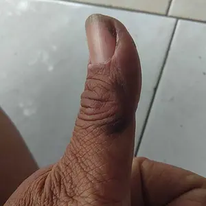 CS Lab 78% - anastesi cream untuk sulam alis tatto Cepat Pulih Perawatan pasca-sulam yang hasil Wajah Mangkok Hitam