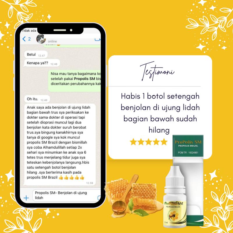 Propolis SM - Untuk Penghilang Kelenjar Mucocele / Ranula Benjolan di Bawah Lidah, Di Mulut / Bibir 3