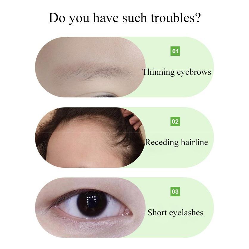 Herbal Hair Growth Tonic/Jus Penumbuh Rambut Usma Serum Herbal Penumbuh Rambut Bulu Mata Alis Rambut Serum Penumbuh Rambut Anti Kebotakan Menebalkan Rambut Mempercepat Pertumbuhan Rambut