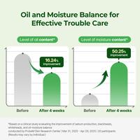 Gambar [NEW ARRIVAL] [Exclusive Creators] TORRIDEN OFFICIAL Balanceful Control Serum 50ml | Acne Care, Pore & Sebum Control Serum dari Torriden Indonesia Kota Tangerang 5 Tokopedia