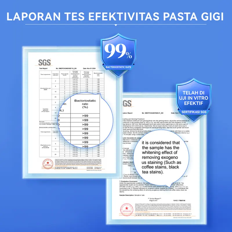 【Diskon Hingga 50%】SOPAMI SP7 Pasta Gigi Pemutih Baking Soda Plus Mint Alami + Pasta Gigi Pelepasan Plak Perlindungan Gusi & Gigi Plus Mint Laut 2Pcs Menghilangkan plak gigi, Melindungi dari gigi berlubang, Merawat gigi, Menyegarkan napas. 7