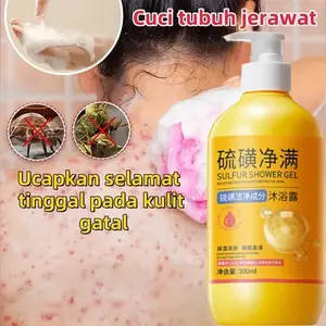 Sabun Sulfur Mandi Belerang 300ml Mengatasi Jerawat Punggung Gatal Jamur dan Bau Badan Deep Cleanse Body Acne & Itch Relief Anti-Acne Anti-Fungal Body Odor Control