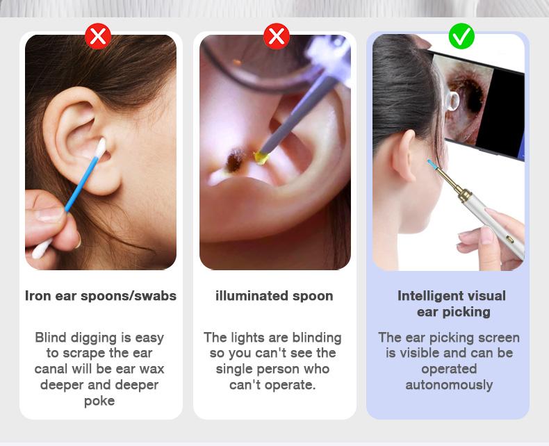 Dr.isla Pembersih Telinga Korek Kuping Kamera 1300W Piksel Dilengkapi dengan fungsi desinfeksi UV Basis pengisian daya smart Visual Ear Stick LED HD EndoscopeWIFI waterproof earpick bayi Endoscope P9 Removal Cleaning