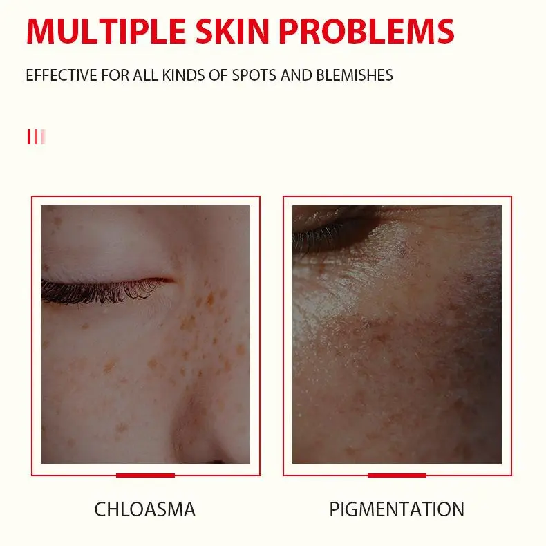MOOYAM niacinamide whitening glutathione serum skincare concentration 2% enriches with vitamin c kojic acid remover facial MOOYAM niacinamide whitening glutathione serum skincare concentration 2% enriches with vitamin c kojic acid remover facial
