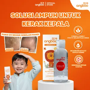 Angboo Hair Oil mengatasi kerak kepala pada anak | Angboo Hair Oil 60ml  dengan Jojoba & Cendlenut Oil Vitamin minyak kemiri rambut bayi haicare