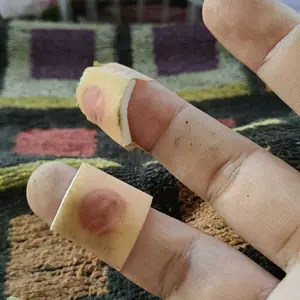 24PCS Plester koyo kaki ampuh plester penghilang mata ikan, kapalan clavus, corn removal patch foot corn remover Mengelupas