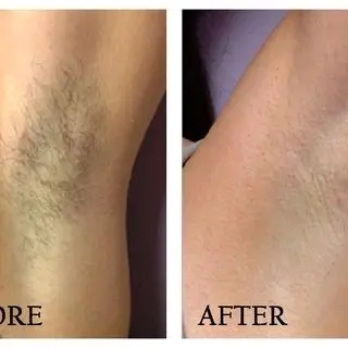 [RIKMAMU] 25ML CYPERUS ROTUNDUS OIL/HAIR REMOVAL/PERONTOK RAMBUT KETIAK 2