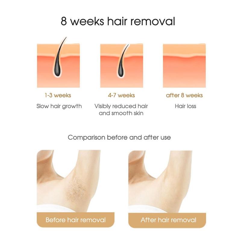 Paopao IPL LASER HAIR REMOVAL TANPA SAKIT EPILATOR / IPL ALAT PENGHILANG BULU PERMANEN IPL Hair Removal Tanpa Rasa Sakit 7