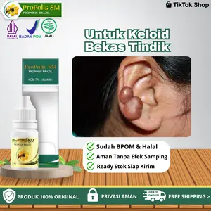 Propolis SM - Untuk Penghilang Keloid Bekas Luka Menonjol Di Telinga,  Keloid Menonjol Bekas Tindik Di Telinga