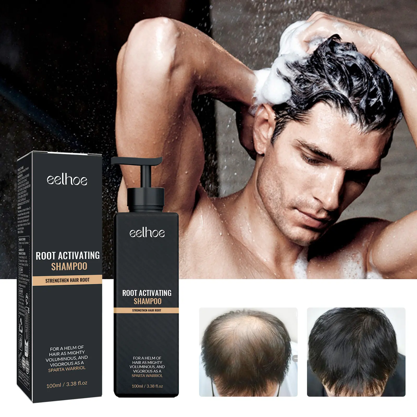 EELHOE Shampo untuk rambut tebal dan mengembang, sampo anti rontok, menghaluskan, menguatkan, memperbaiki dan mengkondisikan sampo bunga  shampoo penumbuh  rambut penumbuh rambut botak Membersihkan  Haircare ketomax  yang non sls  kuda Conditioner Ketombe