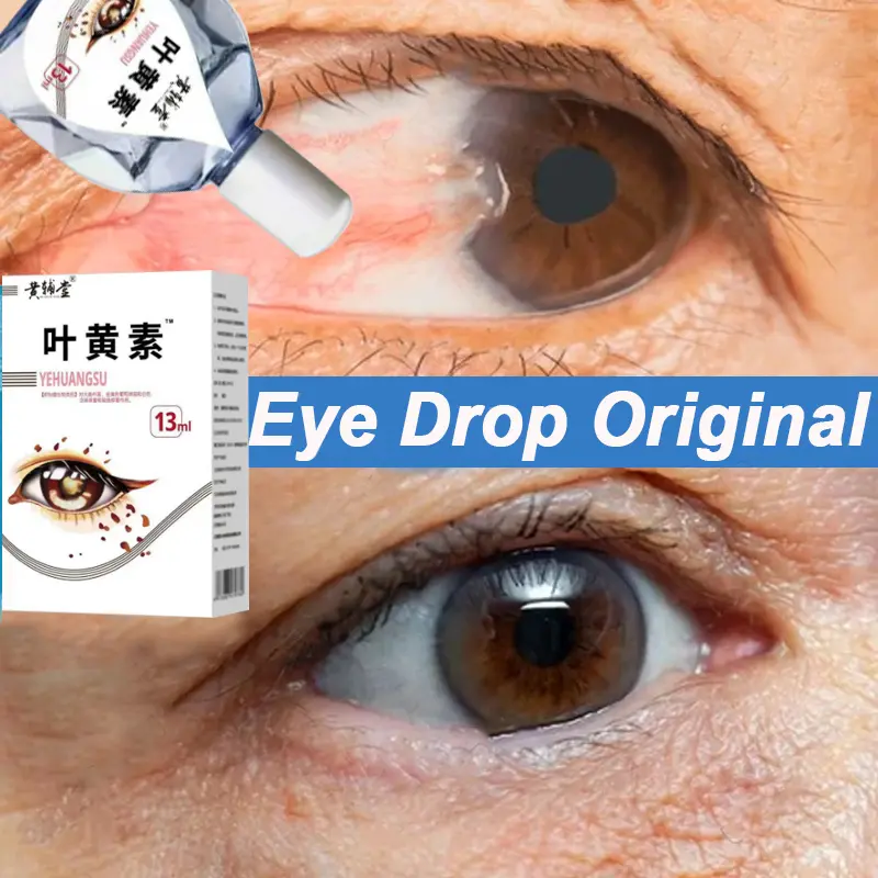 BPOM Tetes Mata Eropa Untuk Katarak Glaukoma cylinder Buram Silau Softlens Lensa Eye Mata minus