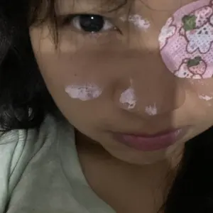 10pcs/Set Terapi Lazy Eyes Mata Malas Eye Patch Anak Mata Juling Amblyopia Penutup Mata Opticlude Orthoptic Ortopad Plester Strabismus Vision Untuk Perawatan Mata Anak Dan Dewasa Therapy Mata Malas