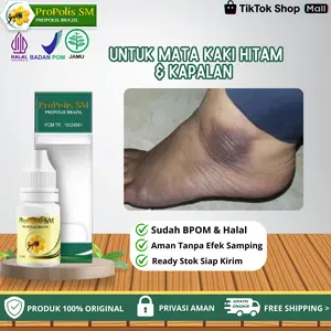 Oles Untuk Mata Kaki Hitam Dan Kapalan / Kulit Keras dan Kasar Pada Mata Kaki - Propolis SM