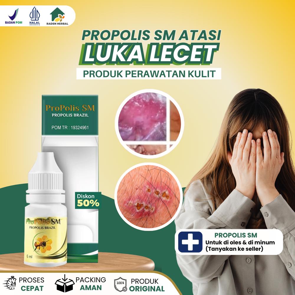 Cairan Oles Untuk Miss V Lecet Luka Gatal dan Perih, Miss V Nyeri Iritasi, Keputihan Bau dan Becek, Jerawat Kelamin - PROPOLIS SM