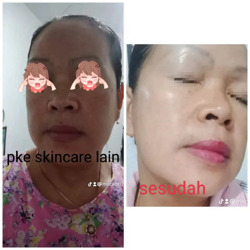 paket whitening kulit sensitif 4