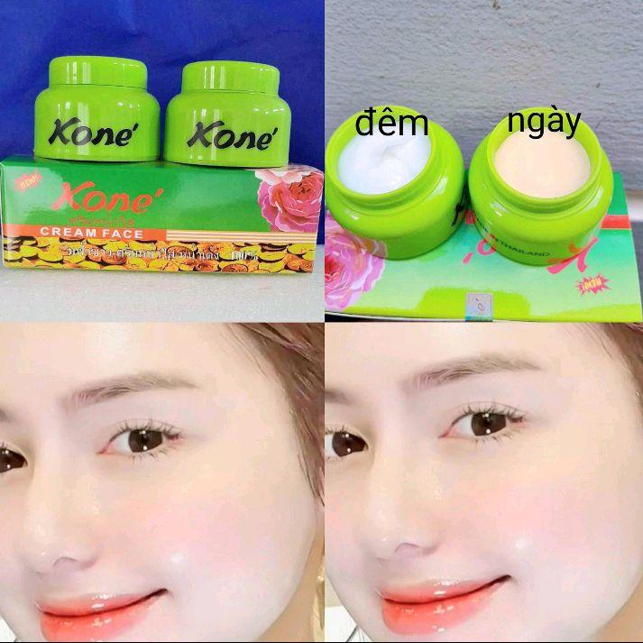  kem kone cặp thái siu trắng. nám sạm tàn nhang đồi mồi thâm mụn và dưỡng trắng da chống nắng 