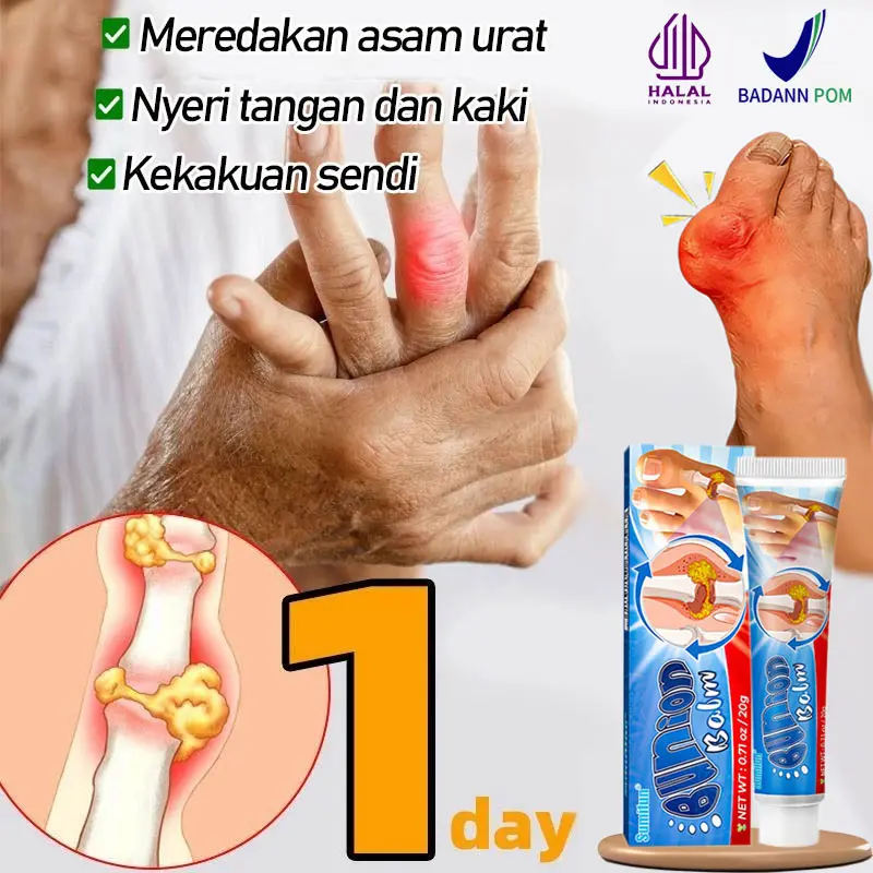 Salep Asam Urat .Salep Kebas Kesemutan Tangan dan Kaki .SalepAsam Urat Bunion Pain Relief Cream. Salep Sendi Tulang  .Salep Bunion Singkirkan tenosinovitis rematik