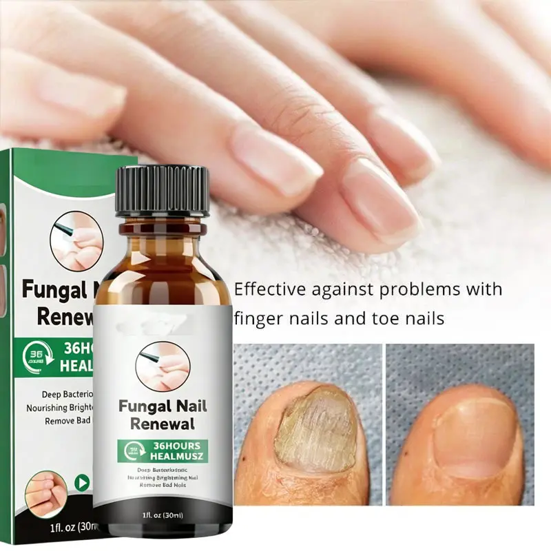 COD Nail Repair Serum Perawatan Obat Jamur Kuku Paling Ampuh Nail Repair Essence Serum Ajaib Viral Di Mengobati Kuku Berjamur Dan Rusak Kuku Jamur Rusak Dan Cantengan Kaki Tangan