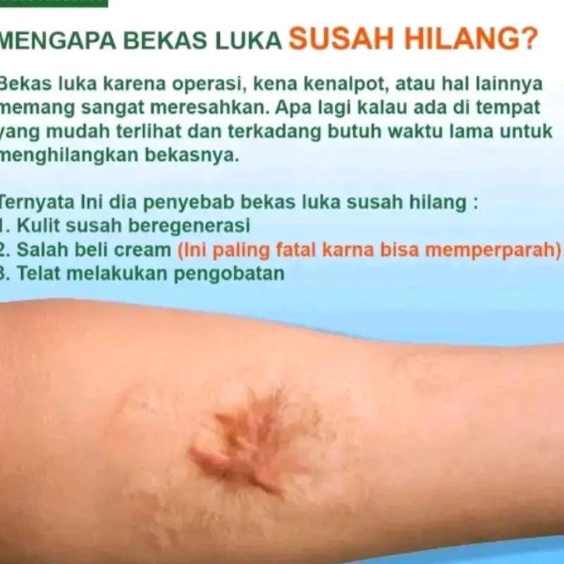 Krim Penghilang Bekas Luka Bio Herbal Meili Beauty Cream 3