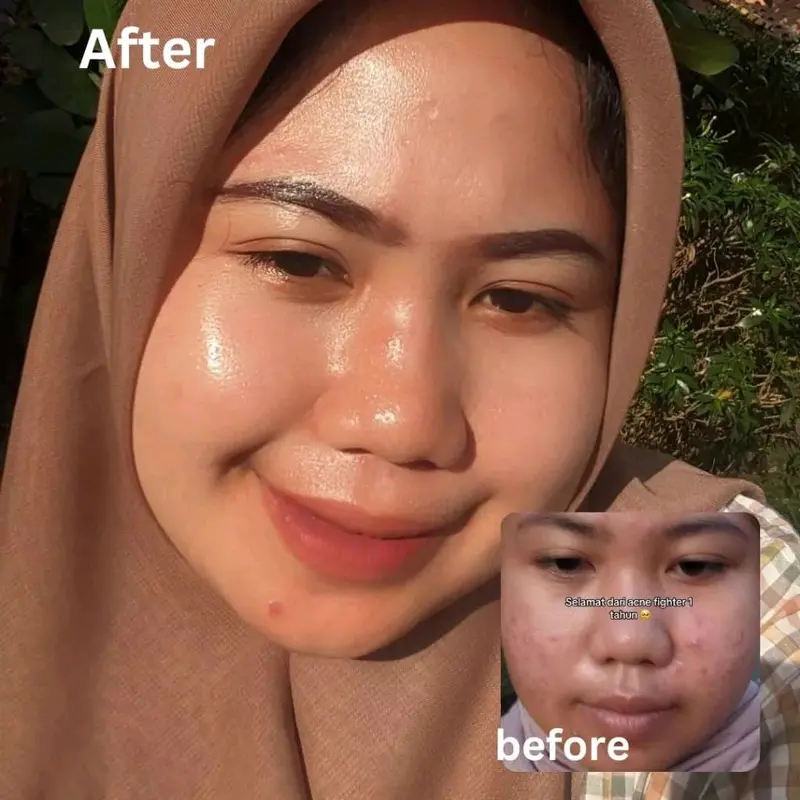 Dosis 1-3 Gloglowing kinclong paket lengkap isi 5 1