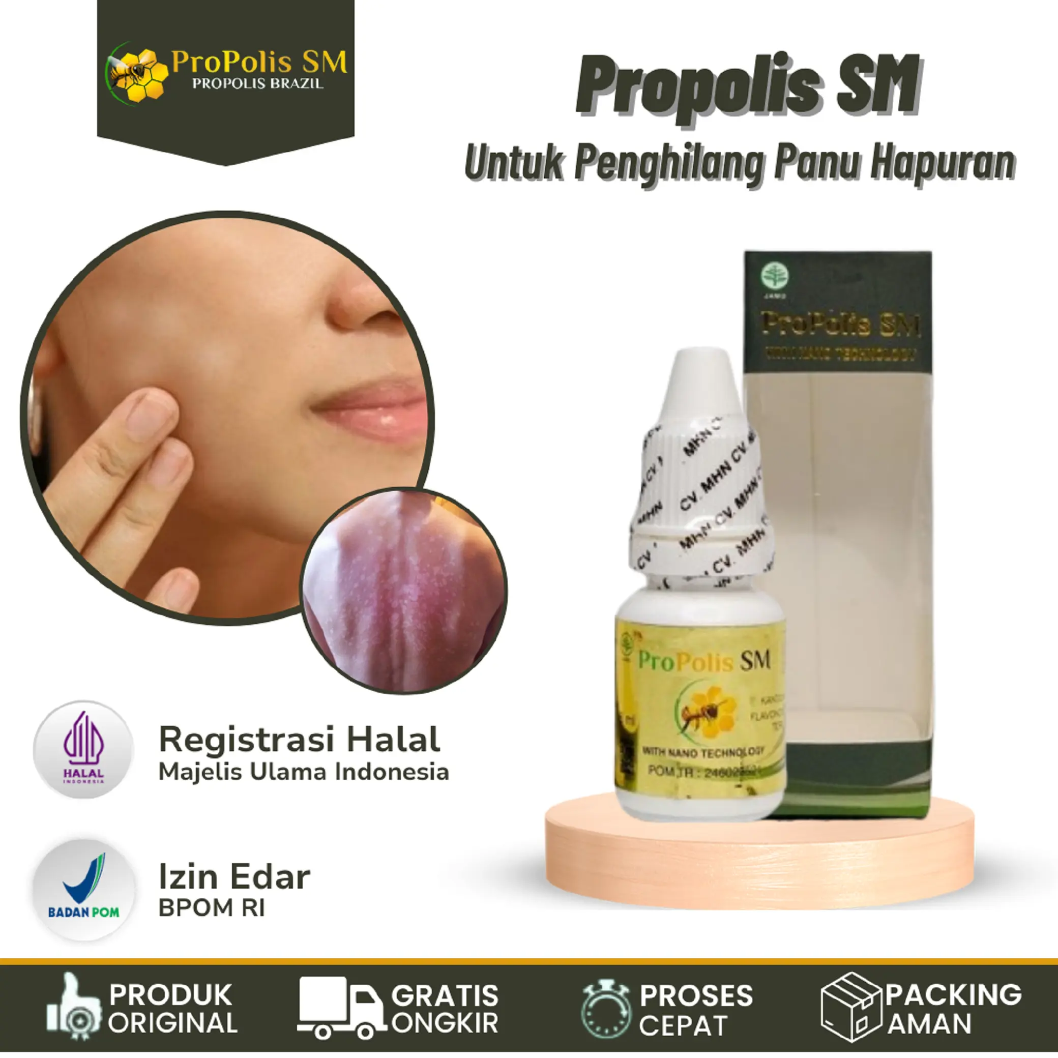 Propolis SM Untuk Panuan,  Panu Di Wajah, Panu Di Leher, Panu Di Punggung, Panu Di Dada, Panu Di Tangan, Hapur, Hapuran, Bercak Putih Di Kulit Isi 6 ml