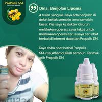 Gambar ProPolis SM Obat Kista Ganglion Benjolan Di Tangan dari Diherbalin Shop Kota Administrasi Jakarta Barat 4 Tokopedia
