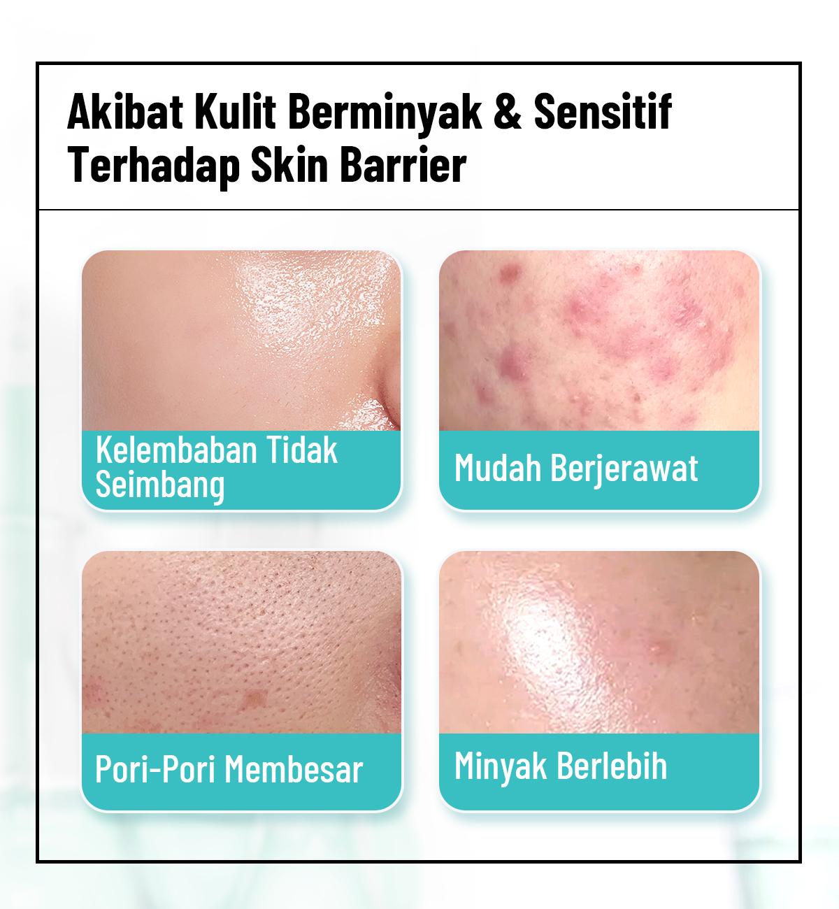 Formulogic: B3-Ceramide Oil-Control Barrier Moisturizer 40 ML | Kontrol Minyak & Perkuat Skin Barrier cream