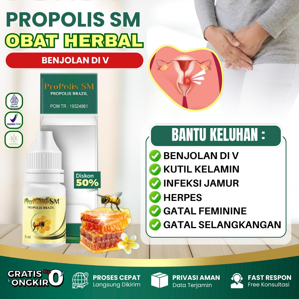 Propolis SM Untuk Benjolan Di Miss V Kutil Kelamin  Infeksi Jamur Feminine Gatal Herpes ORIGINAL - Propolis SM 1 Botol