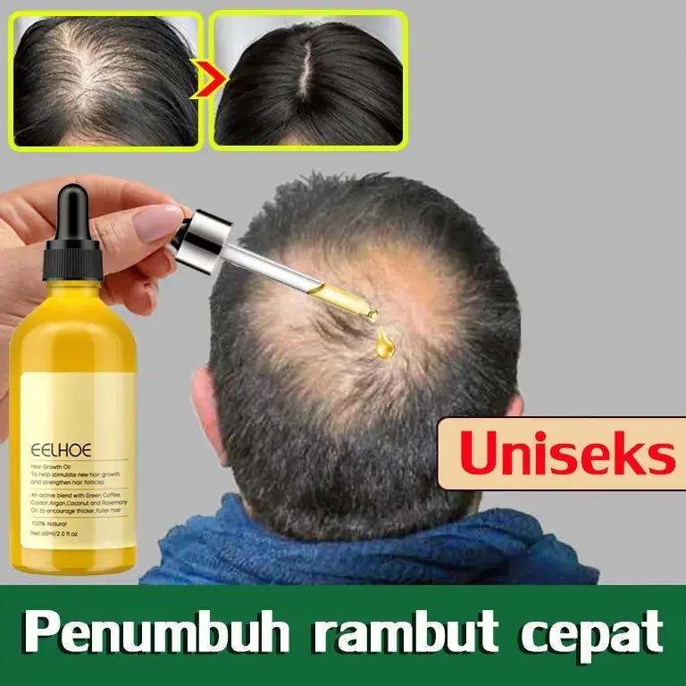rosemary oil rambut rontok rambut rontok dan penumbuh rambut obat ...