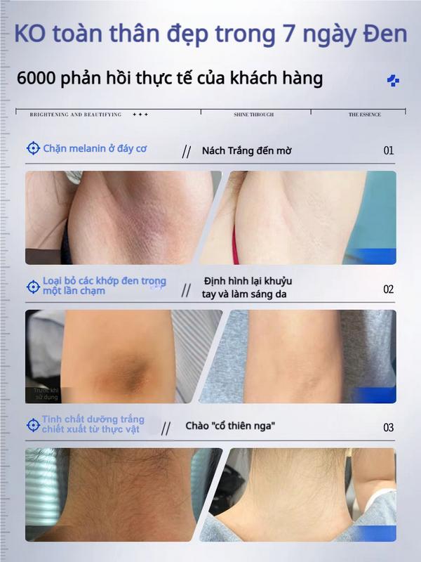 Kem Dưỡng Cải Thiện Sắc Tố Da 30g – Dưỡng Sáng Vùng Nách, Đầu Gối, Khuỷu Tay Với Niacinamide & Chiết Xuất Dâu Tằm – Chăm Sóc Da Toàn Thân 3