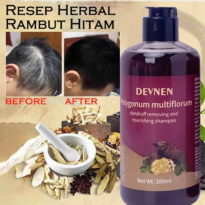 SHAMPO Black Herbal Natural Penyamar Rambut dan Penghiang uban Usia Muda 300ml Shampoo Herbal Polygonum Penghitam Rambut Hitam Dalam Sampo Ketombe Sampo Menghitamkan  Conditioner 1