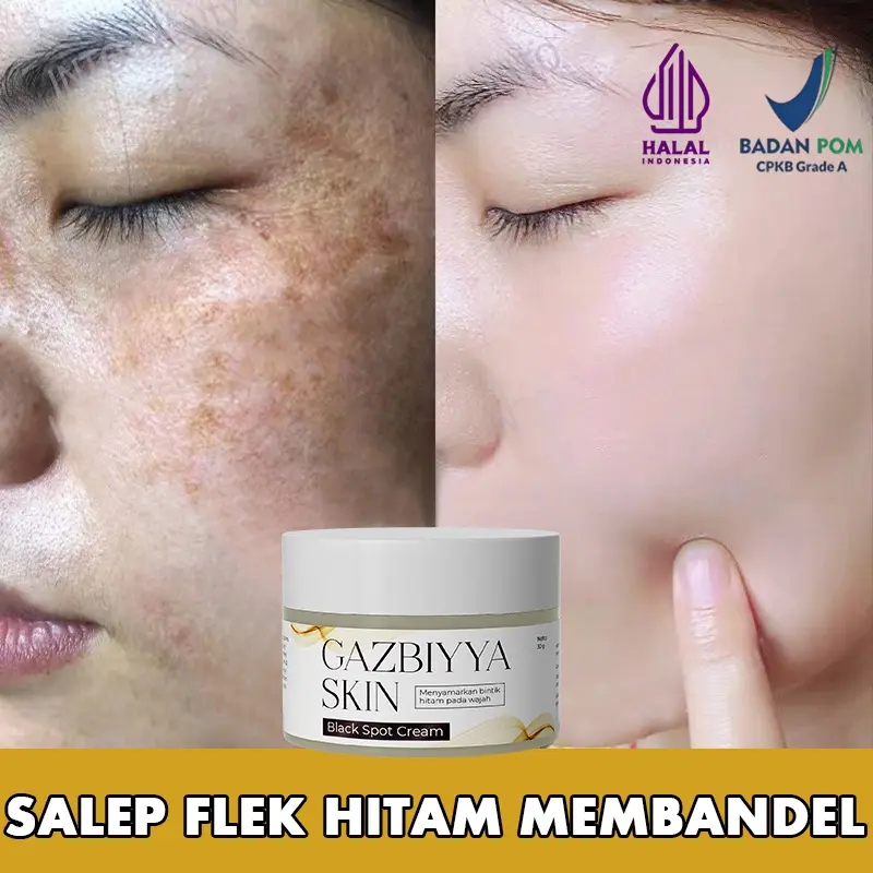Krim penghilang flek hitam cream flek hitam membandel salep flek hitam membandel 30g menghilangkan flek hitam di wajah serum flek hitam Perawatan wajah Krim bintik Perbaikan bekas luka dan bintik bintik secara permanen dan efektif 0