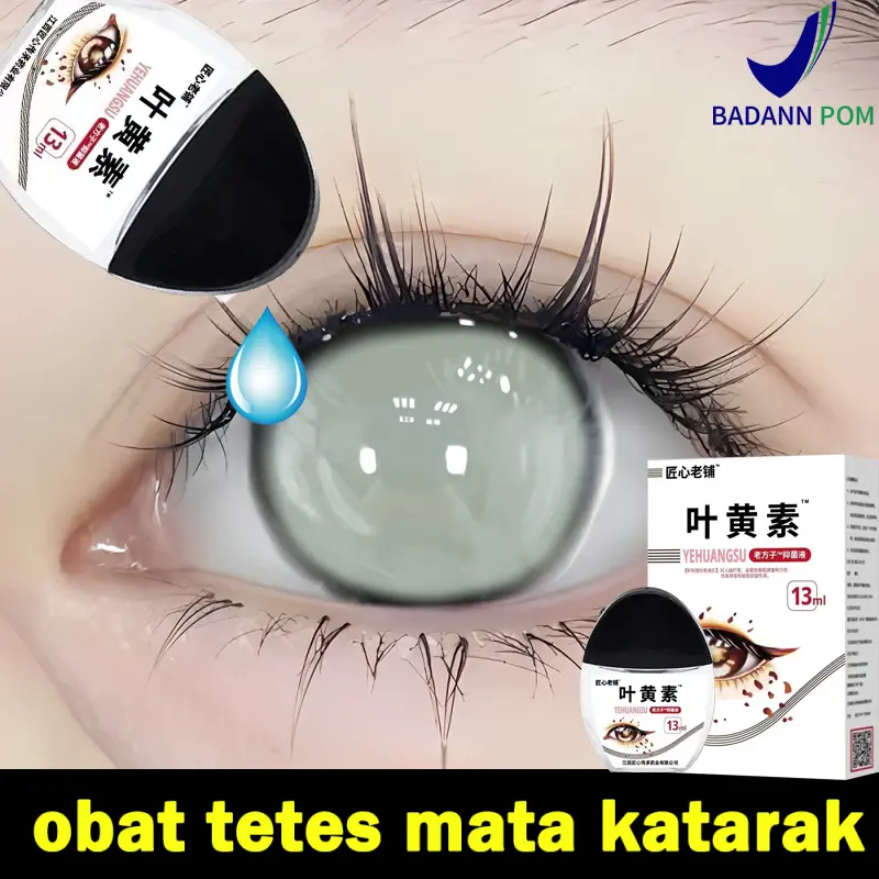 Obat mata obat mata katarak obat tetes mata 15ml